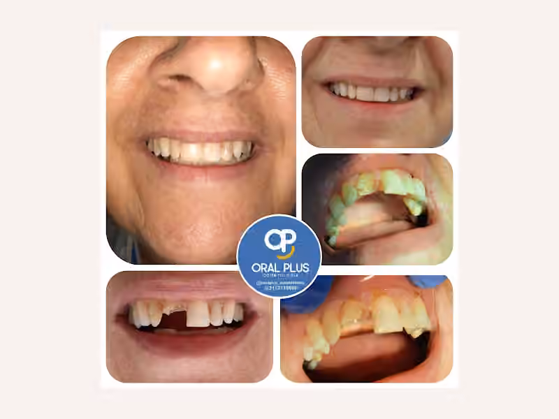 Oral Plus Odontología Montelibano