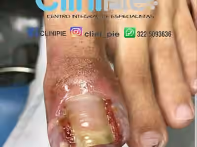 clinipie Colombia